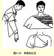 单肩三角巾包扎法