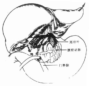 肝门横断后,将肝脏向上翻转,逐根结所肝短静脉