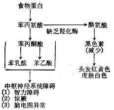 苯丙酮酸尿症的代谢缺陷与临床表现