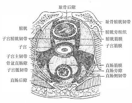 子宫的韧带及盆稻筋膜意旬隙(盆部水平切面模式图)
