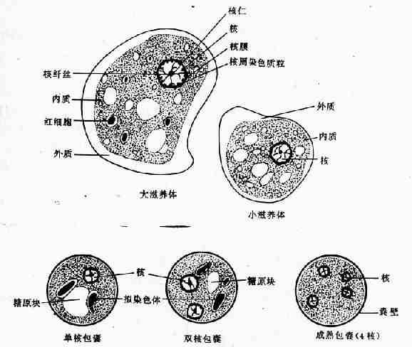 溶组织内阿米巴(铁苏木素染色)