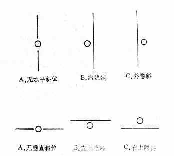 检查结果(马氏杆置右眼前)